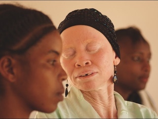 Tanzania Albinism Collective Mini-Documentary