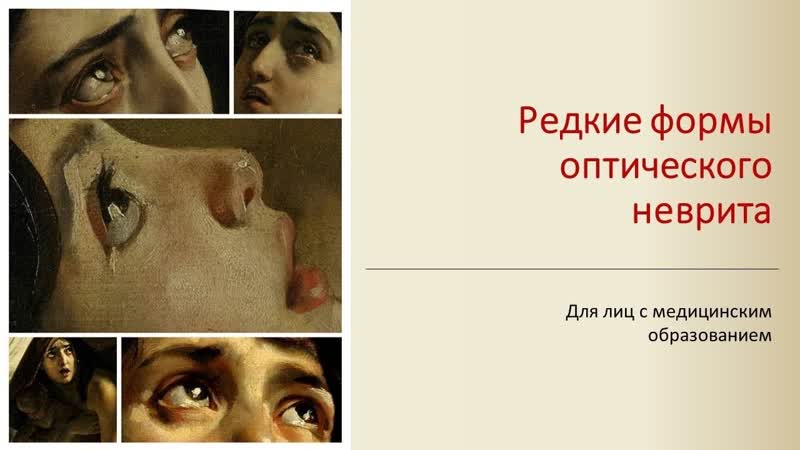 Редкие формы оптического