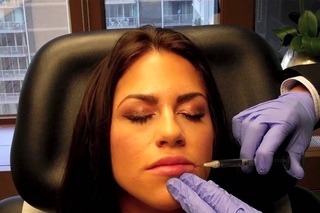 Juvederm Lip Injection Dr Naderi Maryland Virginia Washington DC