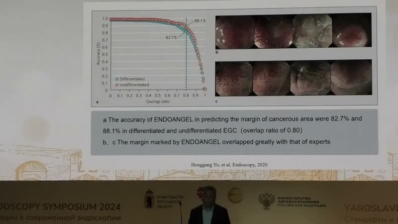 2024 06 21 01 Honggang Yu Artificial Intelligence how Endoangel control the quality of endoscopy
