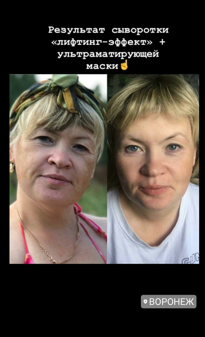 Алёна Чернышова | Воронеж