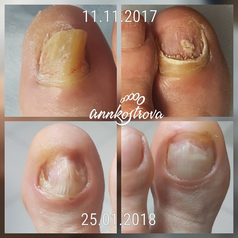 Анна Кострова | Дзержинск