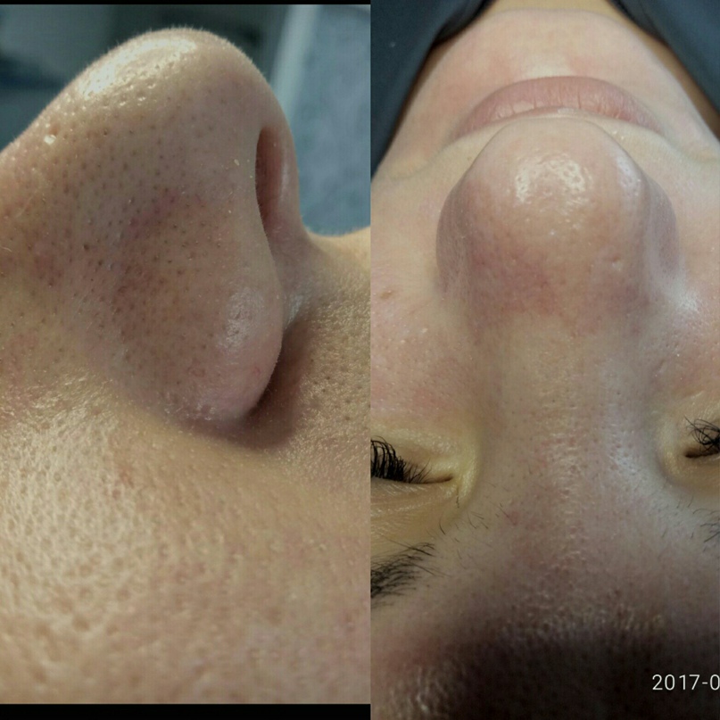 Елена Дорофеева | Арамиль