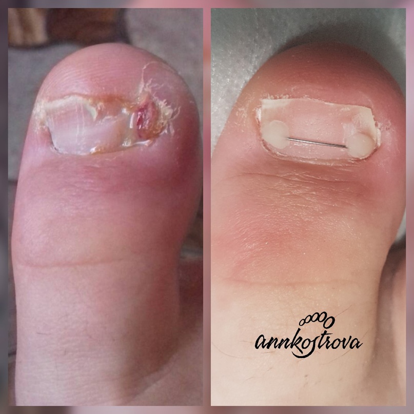 Анна Кострова | Дзержинск