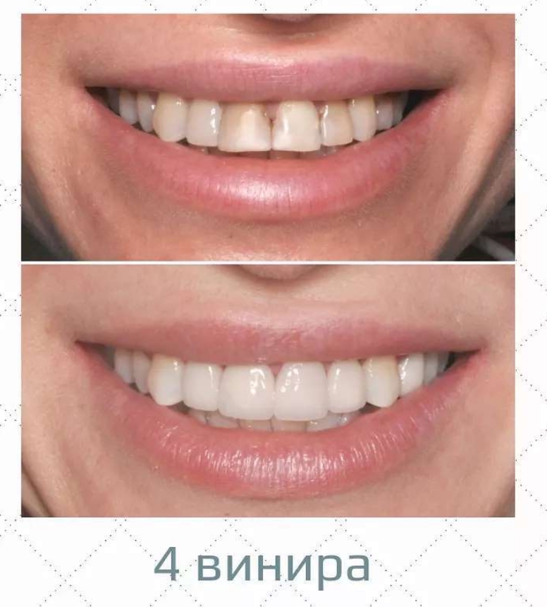 Ирина Крюкова | Волгоград