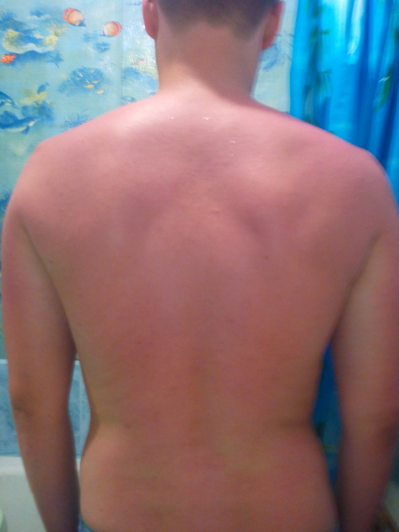 Дмитрий Лысаков | Москва