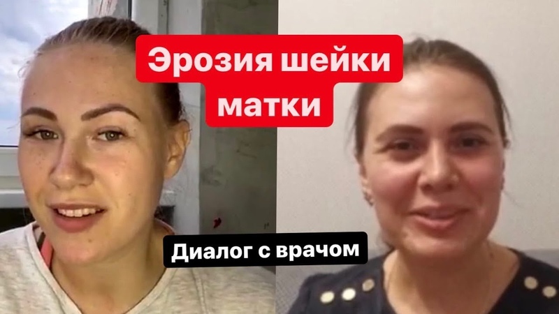 Эрозия. Интервью с врачом гинекологом репродуктологом